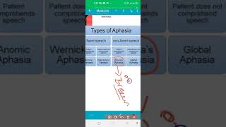 Types of Aphasia  Brocas Aphasia  Wernikes Aphasia mnemonics [upl. by Russian691]