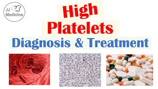 What is Thrombocytosis Diagnosis amp Treatment of High Platelets  Rapid Review [upl. by Ahcurb966]