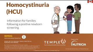 Homocystinuria HCU [upl. by Nedda]