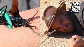 This terrifying wasps sting paralyzes this guys arm [upl. by Bilski]