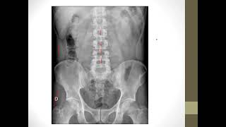 RADIOGRAFIA DE ABDOMENDRANURIA GONZALEZ DUVERGE [upl. by Rudman]