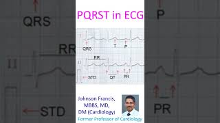 PQRST in ECG [upl. by Campball]