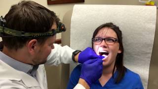 Canker Sore Treatment by Dermatologist Dr David Myers [upl. by Sanferd]