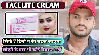 Facelite cream uses dose benefits and Side effects full review in hindi [upl. by Dafodil]