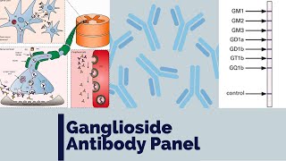 Ganglioside antibody panel  Anti GM1  Immune mediated neuropathy  MMN  MADSAM  CIDP  GBS [upl. by Emmalyn877]