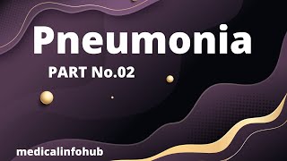 Pneumonia  Diagnosis amp Treatment  CURB65 Score II What is PORT Score  Part 02  COVID19 [upl. by Ahsar]