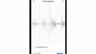 Aortic Stenosis Phonocardiogram  EkoCLINIC App [upl. by Laurice554]