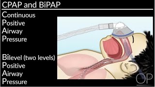 How to Navigate CPAP and BiPAP at Home by L Perlman B Walsh  OPENPediatrics [upl. by Carley]