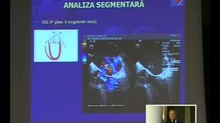Evaluarea ecografică a insuficienţei mitrale [upl. by Hoxie]