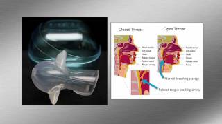 AveoTSD Stop Snoring Anti Apnea Tongue Stabilizing Device [upl. by Dowling]