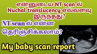 How many ultrasound scans do you need during pregnancy l Max Hospital Pitampura [upl. by Conlee]