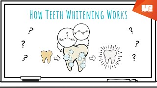 How Teeth Whitening Works [upl. by Glenda]