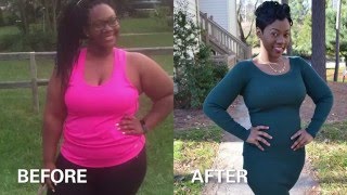 Ashleys Story  Adolescent Bariatric Surgery [upl. by Arelus119]