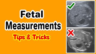 Fetal Measurements Tips and Tricks [upl. by Biel]