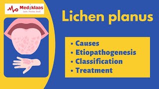 Lichen planus l Causes symptoms treatment l Oral pathology l Mediklaas [upl. by Villada903]