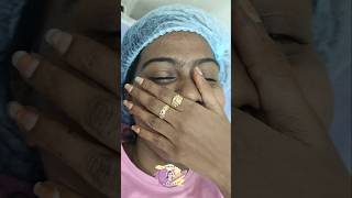 Advanced yellow peel skincare hydrafacialglow glutathioneiv chennai peeling [upl. by Fini]