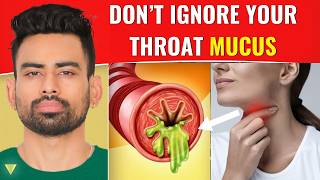 How to Clear Excess Throat Mucus [upl. by Haye243]