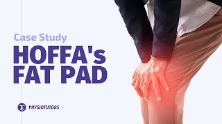 Hoffa Fat Pad Case Study [upl. by Rosella]