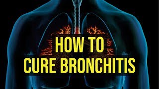 How To Cure Bronchitis Fast  5 Quick Ways [upl. by Oinimreh]