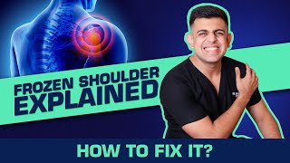 How To Manage Frozen Shoulder  Causes and Treatment [upl. by Leviralc]