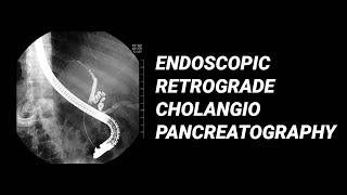 ERCP vs MRCP [upl. by Nilyad]