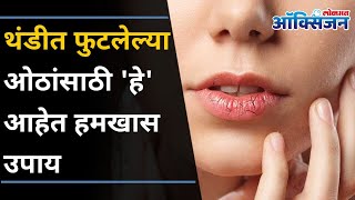 थंडीत फुटलेल्या ओठांसाठी घरगुती उपाय  5 Ways to Treat Chapped Lips  Home Remedies  Lokmat Oxygen [upl. by Aleemaj]