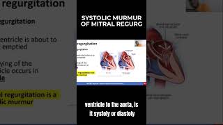 Systolic Murmur of Mitral Regurgitation  MCCQE1 [upl. by Groot]