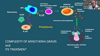 Management of autoimmune disorders in patients with thymic epithelial tumors [upl. by Karalee]