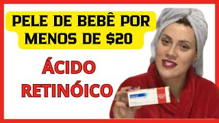 VITACID NO ROSTO É BOM  TRETINOÍNA VITAMINA A [upl. by Grimona934]