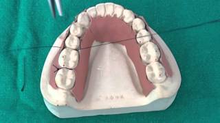 Peridontal Suturing Techniques [upl. by Kielty472]