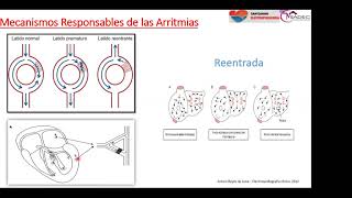 12  Extrasístoles auriculares y ventriculares [upl. by Cressi]