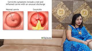 CERVICITIS  Inflammation Of Cervix  PID  Uterus Infection [upl. by Eneiluj]