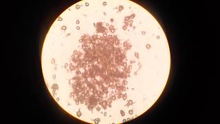 Ammonium biurate crystals [upl. by Pierpont]