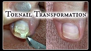 Pedicure Tutorial Toenail Transformation and Time Saving Tips ✔ [upl. by Holds588]