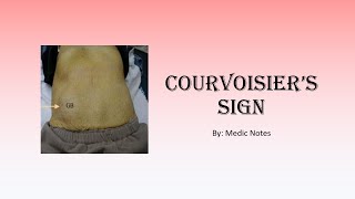 Courvoisiers sign pathophysiology Courvoisiers law [upl. by Klug752]