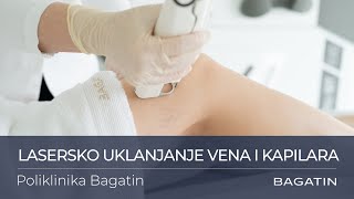 Lasersko uklanjanje vena i kapilara u Poliklinici Bagatin [upl. by Padraic821]