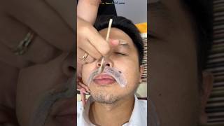 Transparent wax hair removal mustache [upl. by Jermayne]