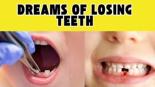 Dreams of Losing Teeth Meaning and Interpretation [upl. by Tocci]