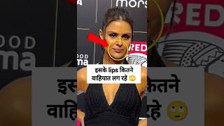 Priyanka got lips surgery 😱 priyankachaharchoudhary ytviral ytviralshorts [upl. by Urba]