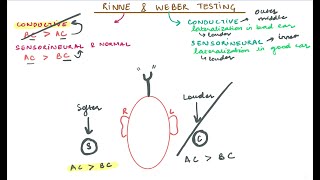 Rinne amp Weber Testing [upl. by Dnyletak306]