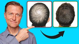 How to Help Regrow Your Hair UPDATED VITAL INFO [upl. by Boys]