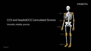 Medartis CCS headedCCS Cannulated Screws Trailer 2024 [upl. by Lanod]