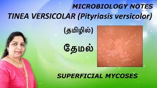 Tinea versicolar Pityriasis versicolar தேமல் Superficial mycosisMicrobiology notes Dr Blessy [upl. by Farrah]