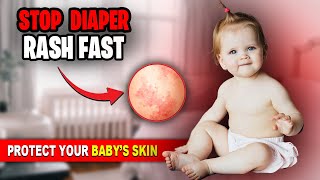 BABY SKIN CARE Preventing and Treating DIAPER RASH [upl. by Ylro21]