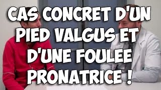 Blog course à pied Cas concret dun pied valgus et dune foulée pronatrice [upl. by Naujahs]