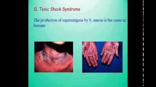 Gram positive cocci StaphylococcusStreptococcusMicrococcus Greasy pig diseasepyoderma of dogs [upl. by Paris499]