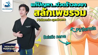 ปวดร้าวลงขา สลักเพชรจมPiriformis syndrome ฟิตได้ง่ายๆ ทำได้ที่บ้าน หมอชวนฟิต [upl. by Annaicul]