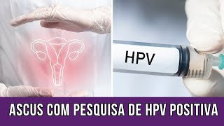 Qual a recomendação para ASCUS com pesquisa de HPV positiva [upl. by Enaed]