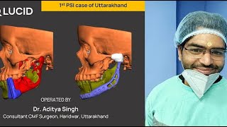 Resection and Reconstruction of Mandible  TMJ with PSI [upl. by Oyek]