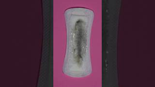 Why Is My Discharge Grey Could It Be Bacterial Vaginosis BV [upl. by Gasper759]